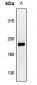 Anti-Collagen-pan Antibody