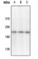 Anti-VEGFR2 (pY1054/Y1063) Antibody