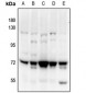 Anti-PAK4/5 Antibody