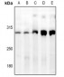 Anti-ATRX Antibody