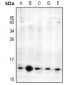 Anti-MED21 Antibody