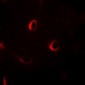 Anti-ECRG4 Antibody