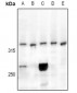 Anti-CELSR3 Antibody