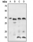 Anti-IGFBP7 Antibody