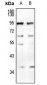 Anti-CD66a/b/c Antibody