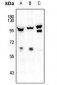 Anti-FOXO1/3/4 (pT24/32) Antibody