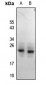 Anti-RGS1/8/16 (pY187/159/168) Antibody