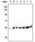 Anti-Alpha-tubulin (pY272) Antibody