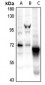 Anti-CaMK2 beta Antibody