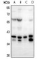 Anti-FOXB1/2 Antibody