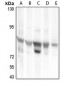 Anti-RhoBTB1 Antibody