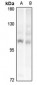 Anti-PRKD1/2/3 Antibody