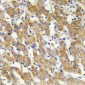 Anti-Cytochrome P450 2C8/9/18/19 Antibody