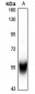 Anti-Cytochrome P450 2C8/9/18/19 Antibody