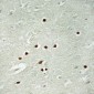 Anti-ANKRD26 Antibody