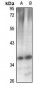 Anti-CCS Antibody