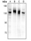 Anti-NPR2 Antibody