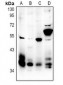 Anti-MCH Receptor 1 Antibody