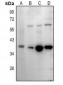 Anti-IgA1/2 Antibody