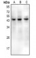 Anti-CD159a/c Antibody