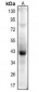 Anti-Actin-pan (AcK52/50/51) Antibody