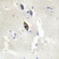 Anti-EPHB1/2/3 Antibody