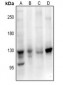 Anti-EPHB1/2/3 Antibody