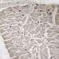 Anti-Collagen 16 alpha 1 Antibody