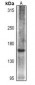Anti-Collagen 16 alpha 1 Antibody
