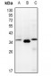 Anti-TCEAL3/5/6 Antibody
