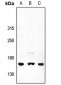 Anti-ATP7A Antibody