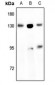 Anti-EPHB1/2 Antibody