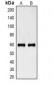 Anti-Cytokeratin 6 Antibody