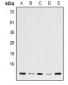 Anti-Histone H2B Antibody