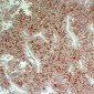 Anti-CD99 Antibody