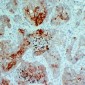 Anti-Cytokeratin 5/6 Antibody