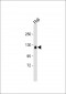 RB1 antibody(S780)