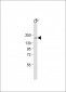 Tuberin (TSC2) Antibody (S1798)