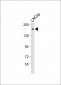 Tuberin (TSC2) Antibody (S1798)