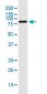 VPS35 monoclonal antibody (M02J), clone 2D3