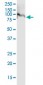 VPS35 monoclonal antibody (M02J), clone 2D3