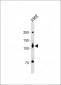 ROR2 Antibody (N-term)