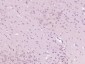 GTP cyclohydrolase 1 Polyclonal Antibody