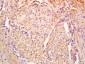 GCDFP15 Polyclonal Antibody