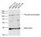 Thyroid peroxidase Polyclonal Antibody