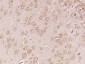 ABCD2 Polyclonal Antibody