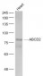 ABCD2 Polyclonal Antibody