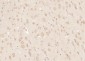 RRAGA + RRAGB Polyclonal Antibody