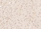 RRAGA + RRAGB Polyclonal Antibody