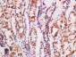 CTR1 Polyclonal Antibody